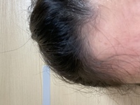26歳女 髪の毛のうねり アホ毛が酷いです アイロンで伸ばしたり 一時期は縮 Yahoo 知恵袋