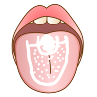 今朝から舌がピリピリ と痛くて でも ご飯は普通の味覚でしたの Yahoo 知恵袋