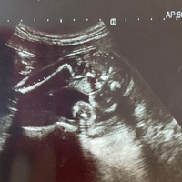 妊娠25週です エコー写真の性別判定なんですが産婦人科では3回連絡で女の子 Yahoo 知恵袋