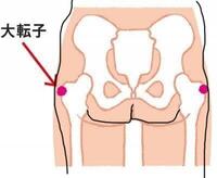 1週間で大転子を引っ込める方法ありますか とりあえず バレリーナの立 Yahoo 知恵袋