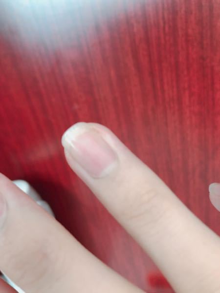 爪のピンク色の部分を広くするにはどうすればいいですか 男で Yahoo 知恵袋
