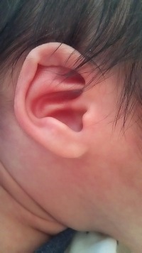 この耳はダウン症ですか 片方の手も手相 で真っ直ぐな線があります Yahoo 知恵袋