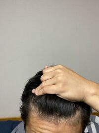 高校2年です これは 生え際後退してますか わかることを 教 Yahoo 知恵袋