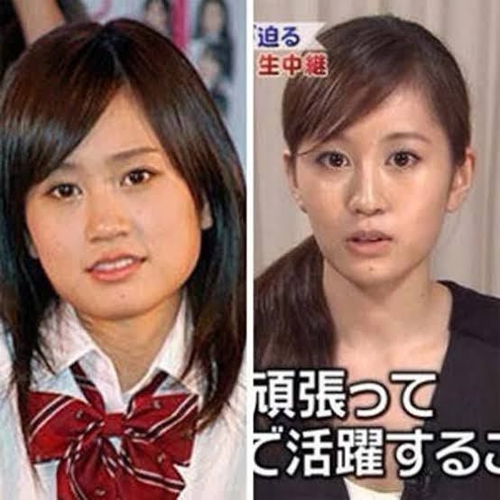 前田敦子ってエラ削りました 痩せただけ Yahoo 知恵袋