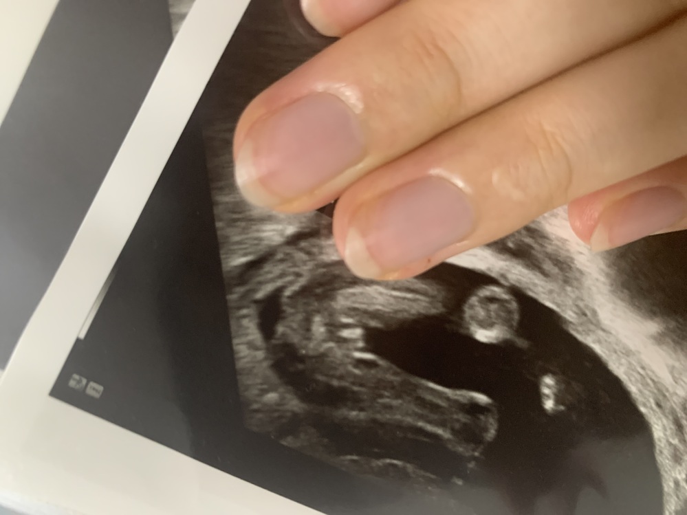 妊娠 出産 すべての質問 Yahoo 知恵袋