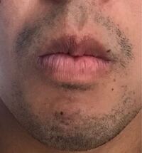 高校生です 今非常に悩んでいることがあります それは ヒゲが濃いことです 1 Yahoo 知恵袋