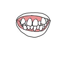 この歯並びの歯列矯正はどのくらいの料金かかりますか 期間も出来れば知りたいで Yahoo 知恵袋