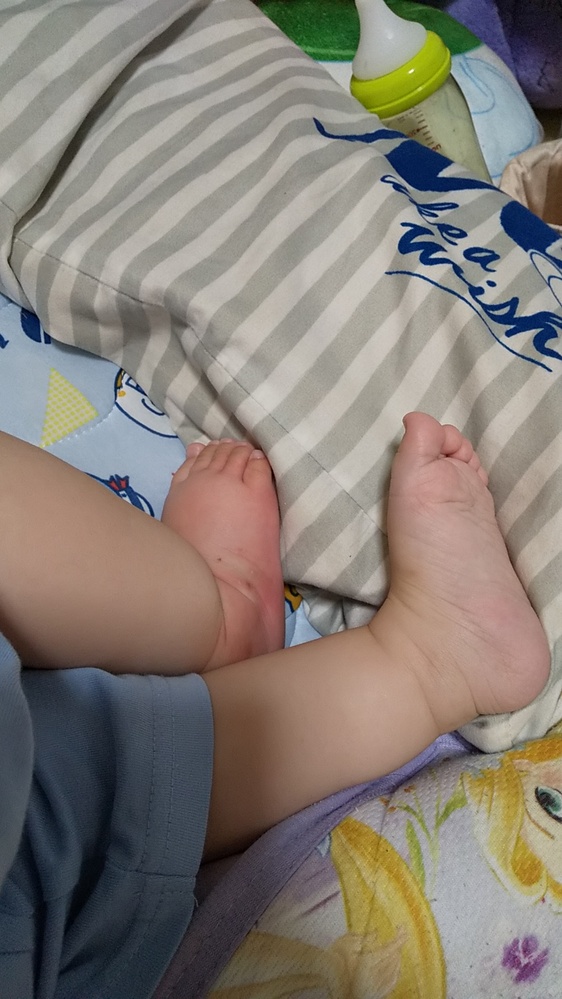 子どもの病気とトラブル 解決済みの質問 Yahoo 知恵袋