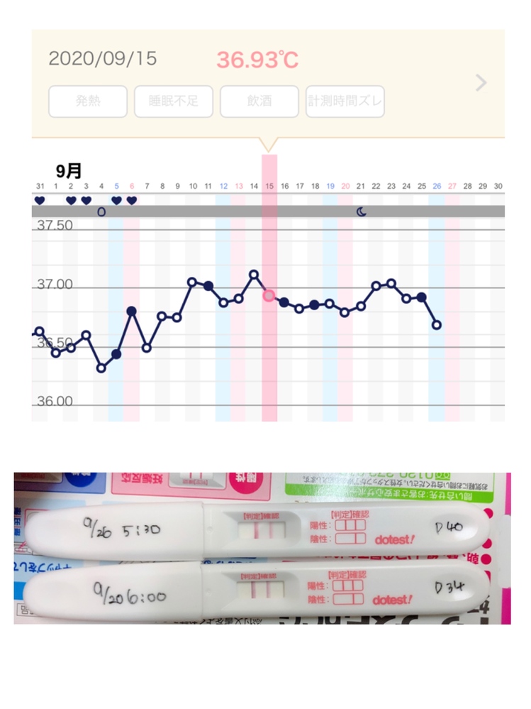 妊娠 出産 解決済みの質問 Yahoo 知恵袋