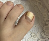 足の爪が白いのが気になります 1年くらいずっと足の爪の親指だけが写 Yahoo 知恵袋