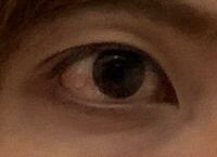 最近目の周りにくぼみができ始めました 写真の様に目の上にもくぼみがあります Yahoo 知恵袋