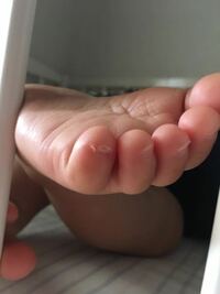 10ヶ月の子供の足の爪が根元まで縦に割れてしまいました どう Yahoo 知恵袋