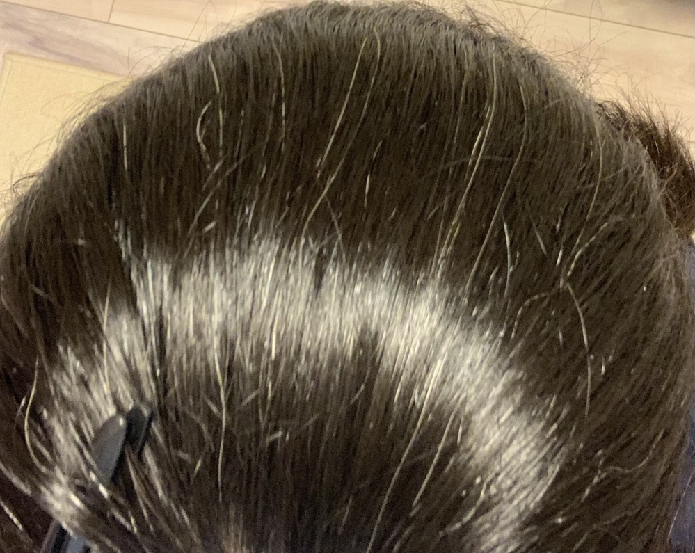 若白髪で悩んでます 親が若白髪多かったので私も小学生の時から若白髪あって 今 Yahoo 知恵袋