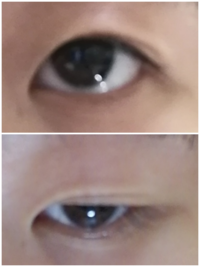 オロナインを目の周り まぶた に塗っても大丈夫でしょうか Yahoo 知恵袋