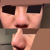 メガネについて 自分は鼻が大きいです よく友達とかに言われます 試しに親のメガ Yahoo 知恵袋