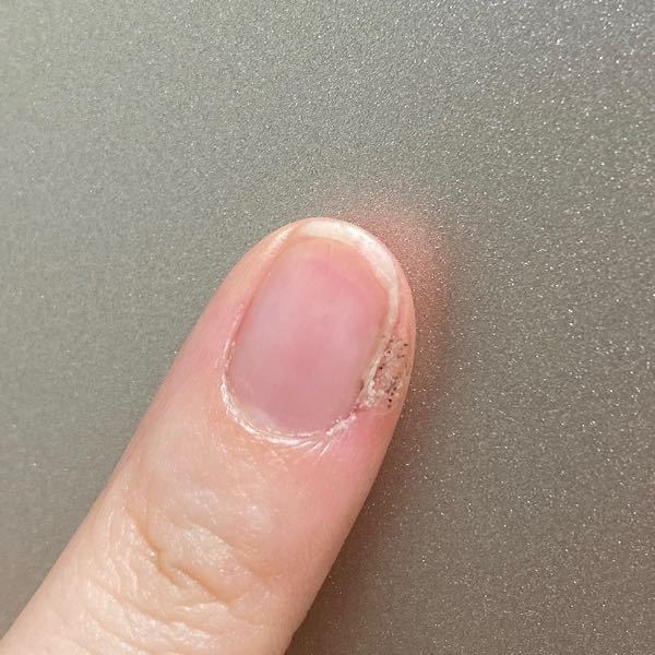 小爪 に関するq A Yahoo 知恵袋