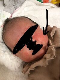 頻回授乳はいつまで 生後１ヶ月の女の子です 現在は母乳寄りの混 Yahoo 知恵袋