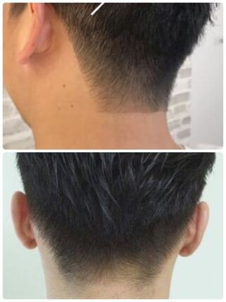 メンズヘアスタイル襟足の刈り上げについて 自分は画像の下の写真 Yahoo 知恵袋