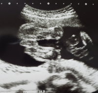 妊娠22週目のエコー写真にしっぽ 妻が妊娠22週目に入りまし Yahoo 知恵袋