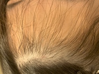 中二女子です 急にくせ毛が生えてきました この前まで全然そん Yahoo 知恵袋