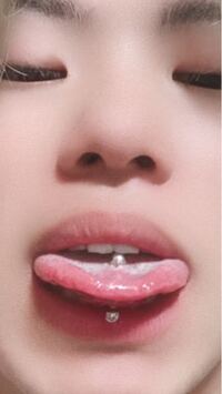 なんでこんなに舌白いんですか 心配ですし 気になったので質問いたし Yahoo 知恵袋