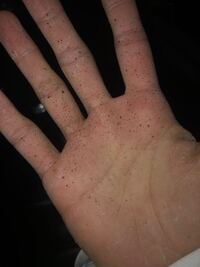 ゴリラ50に乗ってます マフラーから白煙が少量上がるので 気 Yahoo 知恵袋