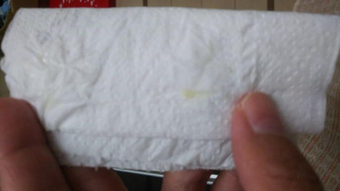 画像あり トイレに行くとショーツにおりものがクリーム色に固まっていてそ Yahoo 知恵袋