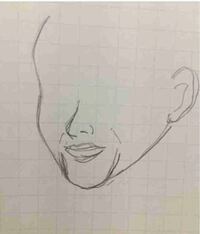 笑うと顎にこのようなu字型の線が出るのがコンプレックスです 原因は Yahoo 知恵袋