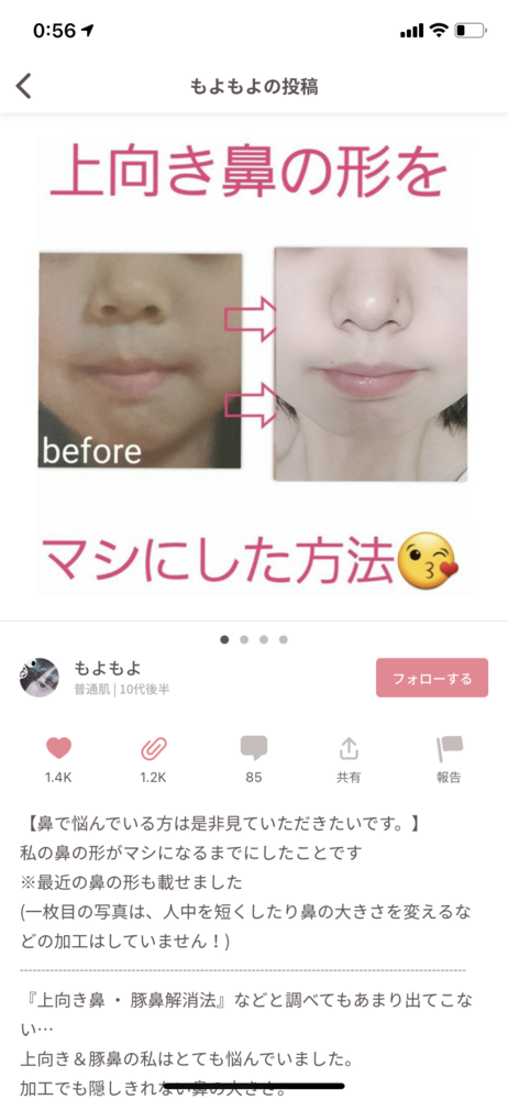 自撮りビフォーアフター写真のコツ - 自社でスキンケア、コスメ 