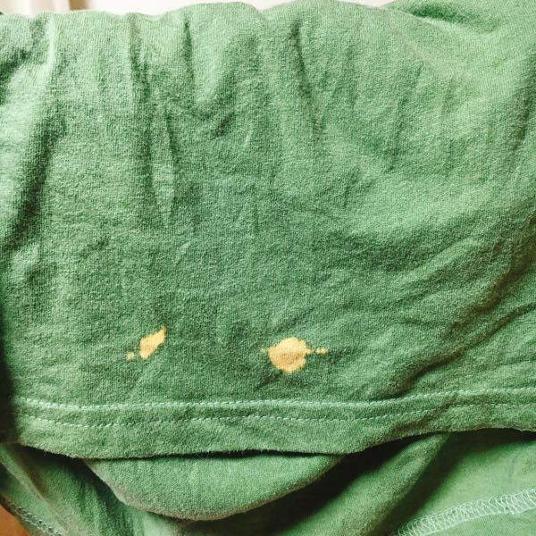 洗濯したら服の色が一部分だけ抜けていました…涙 - これはなぜでしょ 
