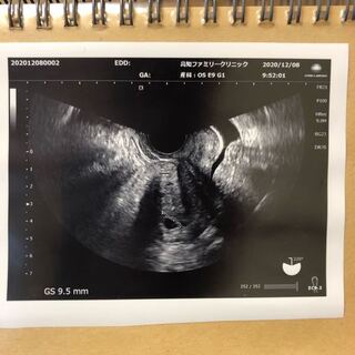 妊娠6週頃に産婦人科に行きました 約6ミリ胎嚢は成長してるん Yahoo 知恵袋