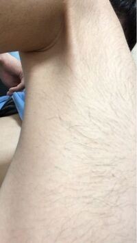 腿裏の毛剃った方がいいですか 女子に質問です Yahoo 知恵袋