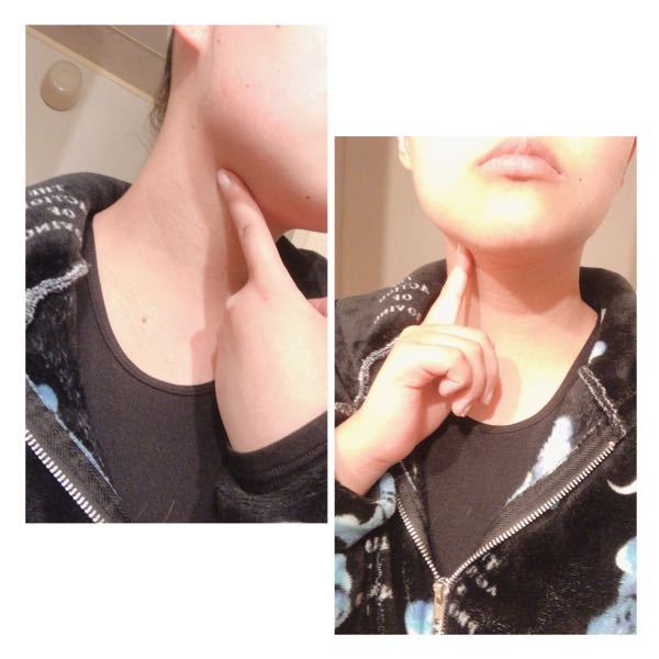 首のしこりっぽいものについてです。 - 昨日何となく首を触っている 