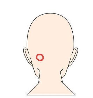 後頭部のうなじの少し上くらい 左側 に昨日からコブのようなものができていて Yahoo 知恵袋