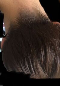 襟足の生えぐせについて 襟足を刈り上げると写真のように変な方向 Yahoo 知恵袋