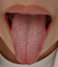 写真あり 舌が白いです どうすれば取れますか 舌専用の歯ブラシを毎日し Yahoo 知恵袋