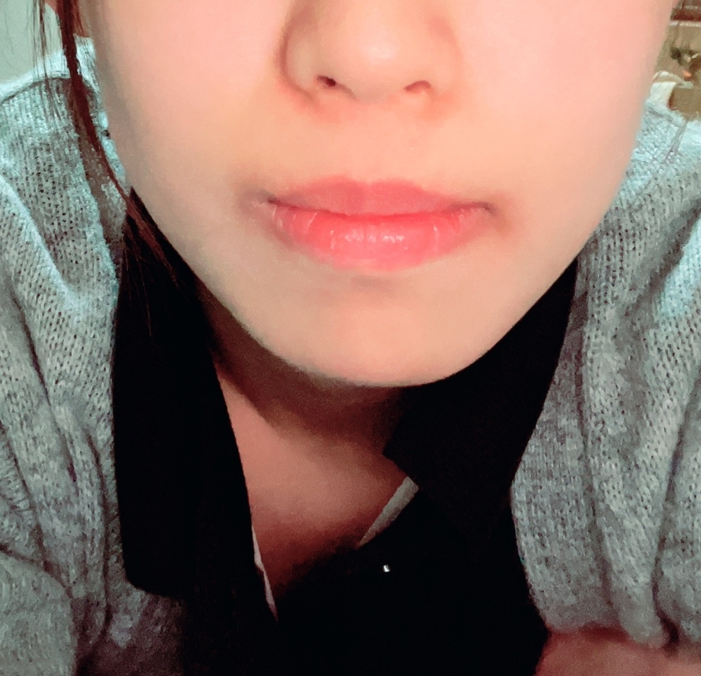 美容整形についてです 私はこのような左右非対称の輪郭をしており整形を考 Yahoo 知恵袋