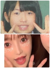 同一人物です 下の写真が整形後です いわゆる整形顔だと思いますか Yahoo 知恵袋