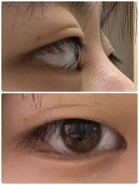 二重の線がついているんですが もっと濃くするにはどうしたらいいですか Yahoo 知恵袋