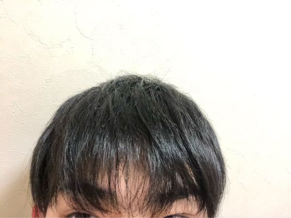 高校生男子です この写真を見る限る僕の前髪は薄いですか 僕は高校生なのにm時 Yahoo 知恵袋