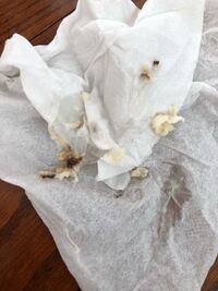 閲覧注意膣から出てきたのですがカンジダでしょうか 痒みがあるならカンジ Yahoo 知恵袋