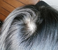 高校1年生女子です最近髪に短い毛がの部分が増えて頭皮が見えています ツ Yahoo 知恵袋