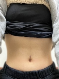 ヘソピアスが曲がってあいています どうしたら ヘソピアスを美容外 Yahoo 知恵袋