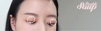 YouTuberのキムスプスプちゃんの両目のこれは何でしょうか(・・?)ずっと前から気になっていて！ 