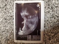 5週2日の妊婦です 妊娠が分かってから初めて検診に行き 胎嚢確認できました Yahoo 知恵袋