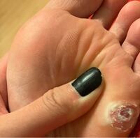 壁 アピール 光の いぼころり 乳首 取れる Lunch To Sweets Jp