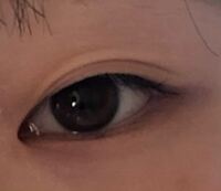 助けてください 朝起きたら二重が一重になっていました ということがよく Yahoo 知恵袋