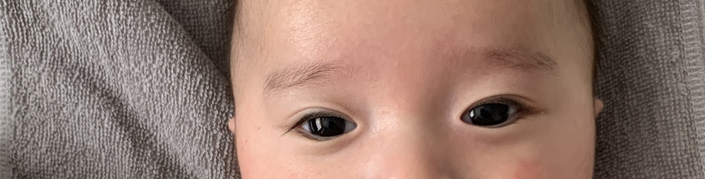 目の病気 解決済みの質問 Yahoo 知恵袋