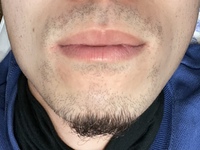 今付き合ってる人なんですけど ヒゲが濃すぎて無理です いつもちゃんと剃 Yahoo 知恵袋