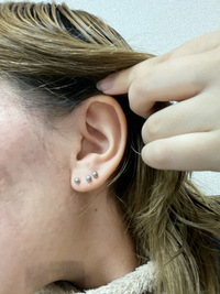 ロブにピアスを増やしたいです だいぶ前に開けたところが偏って Yahoo 知恵袋